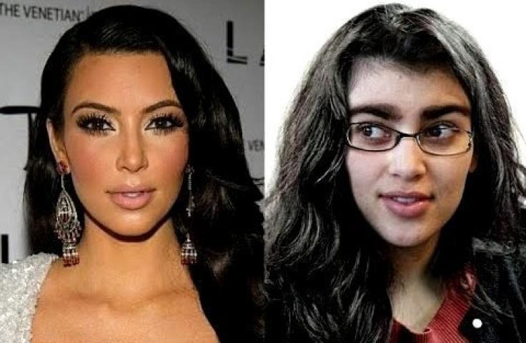 Kim Kardashian: 10 + 1 φωτογραφίες πριν και μετά τις πλαστικές