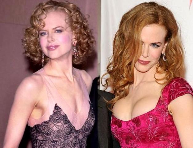 Οι 10 celebrities με τις πιο επιτυχημένες πλαστικές στήθους Οι 10 celebrities με τις πιο επιτυχημένες πλαστικές στήθους