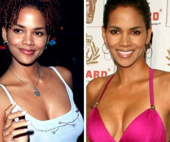 Οι 10 celebrities με τις πιο επιτυχημένες πλαστικές στήθους Οι 10 celebrities με τις πιο επιτυχημένες πλαστικές στήθους