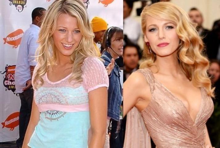 Οι 10 celebrities με τις πιο επιτυχημένες πλαστικές στήθους Οι 10 celebrities με τις πιο επιτυχημένες πλαστικές στήθους