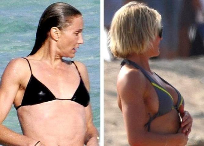 Οι 10 celebrities με τις πιο επιτυχημένες πλαστικές στήθους Οι 10 celebrities με τις πιο επιτυχημένες πλαστικές στήθους