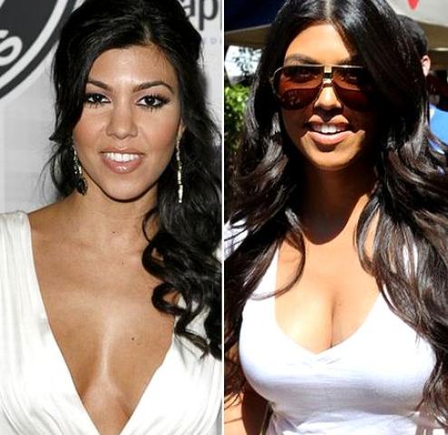 Οι 10 celebrities με τις πιο επιτυχημένες πλαστικές στήθους Οι 10 celebrities με τις πιο επιτυχημένες πλαστικές στήθους