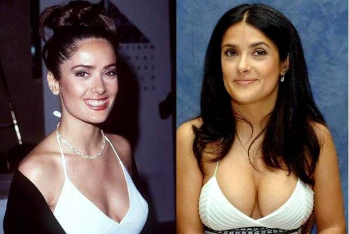 Οι 10 celebrities με τις πιο επιτυχημένες πλαστικές στήθους Οι 10 celebrities με τις πιο επιτυχημένες πλαστικές στήθους