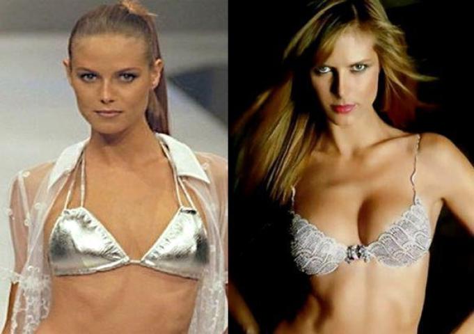 Οι 10 celebrities με τις πιο επιτυχημένες πλαστικές στήθους Οι 10 celebrities με τις πιο επιτυχημένες πλαστικές στήθους