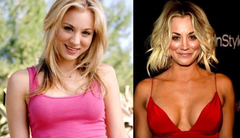 Οι 10 celebrities με τις πιο επιτυχημένες πλαστικές στήθους Οι 10 celebrities με τις πιο επιτυχημένες πλαστικές στήθους
