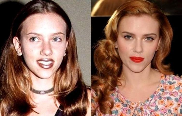 Scarlett Johansson: Τελικά πόσο την άλλαξαν οι πλαστικές;