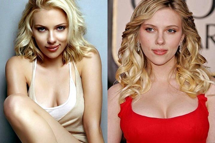 Scarlett Johansson: Τελικά πόσο την άλλαξαν οι πλαστικές;
