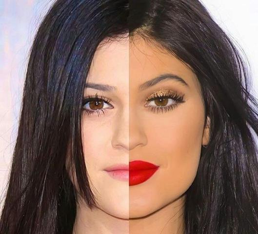 Kylie Jenner: Η ολική «μεταμόρφωση» από τις πλαστικές μέσα από 15 φωτογραφίες 