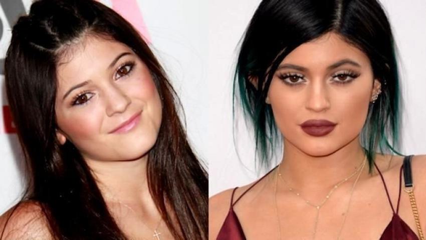 Kylie Jenner: Η ολική «μεταμόρφωση» από τις πλαστικές μέσα από 15 φωτογραφίες 