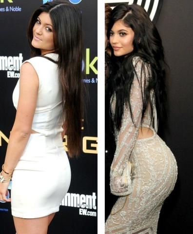 Kylie Jenner: Η ολική «μεταμόρφωση» από τις πλαστικές μέσα από 15 φωτογραφίες 