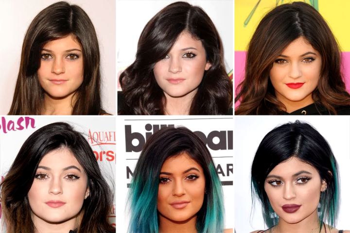 Kylie Jenner: Η ολική «μεταμόρφωση» από τις πλαστικές μέσα από 15 φωτογραφίες 