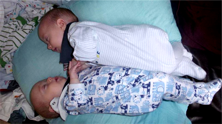 Διδυμάκια ξεγέλασαν τον θάνατο μέσα στη μήτρα της μαμάς τους με τον πιο γλυκό τρόπο