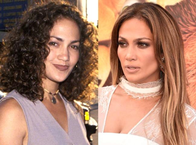 10 celebrities που είπαν «ναι» στην πλαστική μύτης