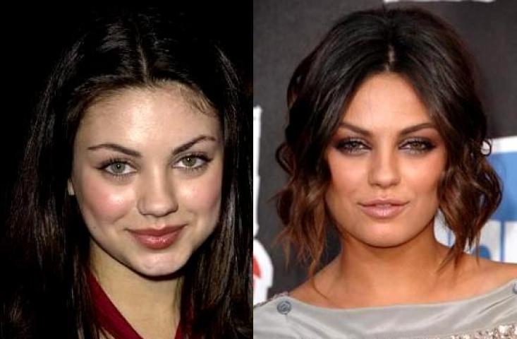 10 celebrities που είπαν «ναι» στην πλαστική μύτης