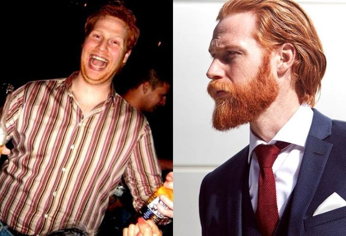 Τo «ασχημόπαπο» έχασε 50 κιλά και κατέληξε μοντέλο που λατρεύουν οι γυναίκες