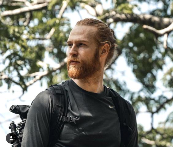 Τo «ασχημόπαπο» έχασε 50 κιλά και κατέληξε μοντέλο που λατρεύουν οι γυναίκες