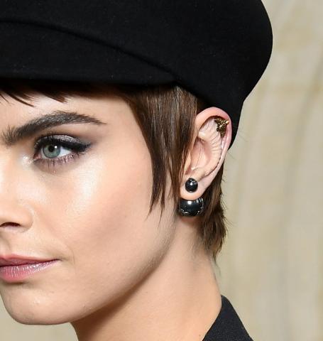 Τι συμβαίνει με το αυτί της Cara Delevingne;