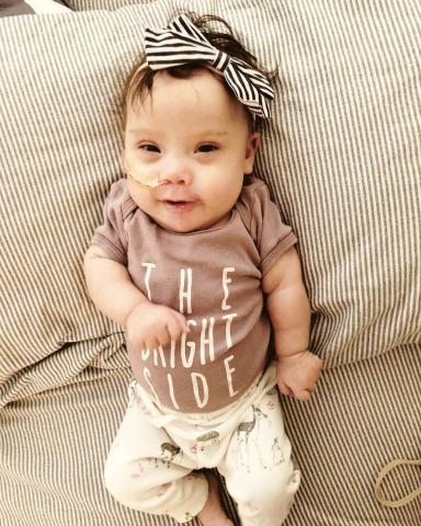 Μαγικό! Μόλις ανακάλυψε ότι το μωρό της έχει σύνδρομο Down έκανε την πιο αξιοθαύμαστη δήλωση