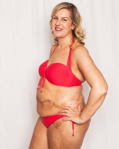 Η καμπάνια – γροθιά στο στομάχι που θα σε κάνει να αγαπήσεις το κορμί σου ακριβώς όπως είναι