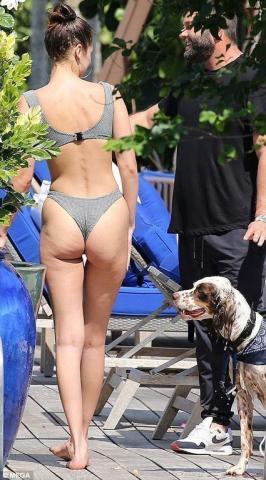 Ποιος είπε πως τα supermodels δεν έχουν κυτταρίτιδα; Οι φωτο της Bella Hadid το αποδεικνύουν