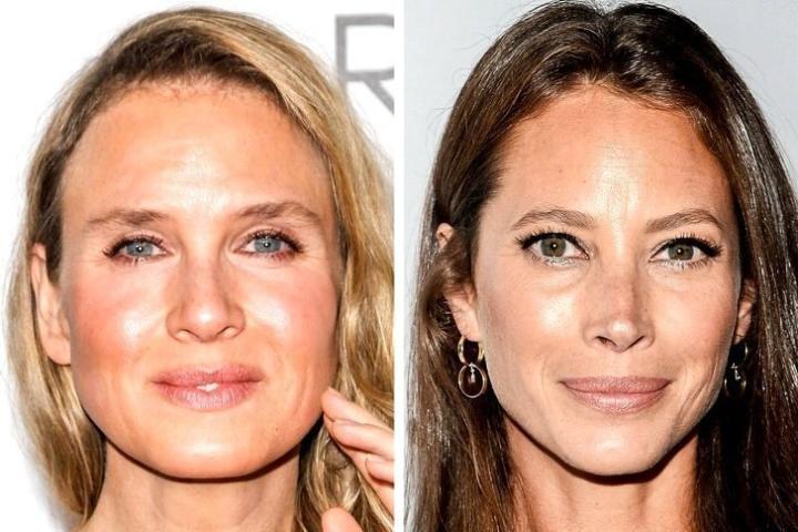 Οι πλαστικές έκαναν (ξανά) το θαύμα τους: Κι όμως, αυτές οι celebrities έχουν την ίδια ηλικία
