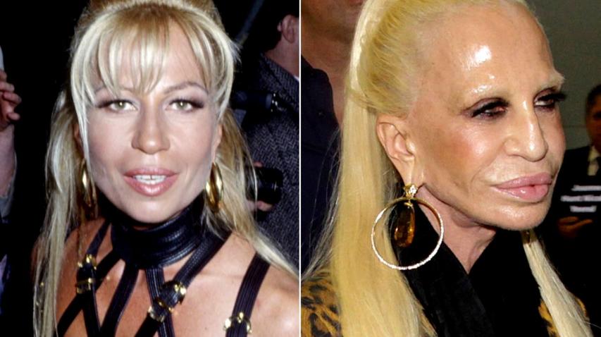 Donatella Versace: Θυμάσαι την όμορφη όψη της πριν τις πλαστικές; Donatella Versace: Θυμάσαι την όμορφη όψη της πριν τις πλαστικές;