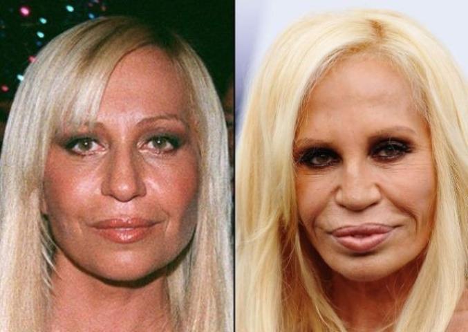 Donatella Versace: Θυμάσαι την όμορφη όψη της πριν τις πλαστικές; Donatella Versace: Θυμάσαι την όμορφη όψη της πριν τις πλαστικές;