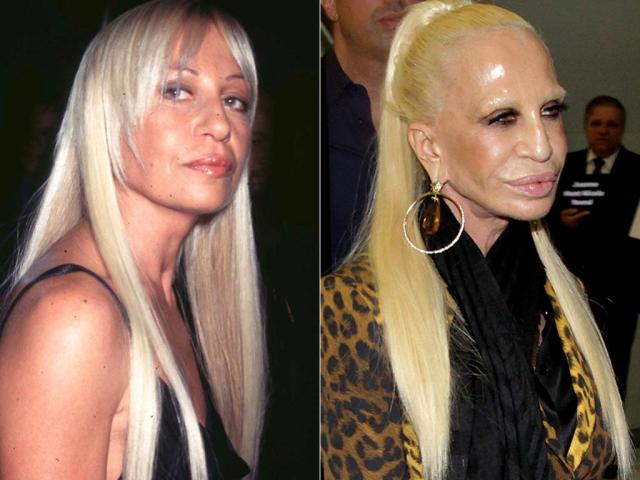 Donatella Versace: Θυμάσαι την όμορφη όψη της πριν τις πλαστικές; Donatella Versace: Θυμάσαι την όμορφη όψη της πριν τις πλαστικές;