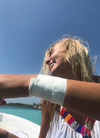 Καρχαρίας δάγκωσε μοντέλο την ώρα φωτογράφισης