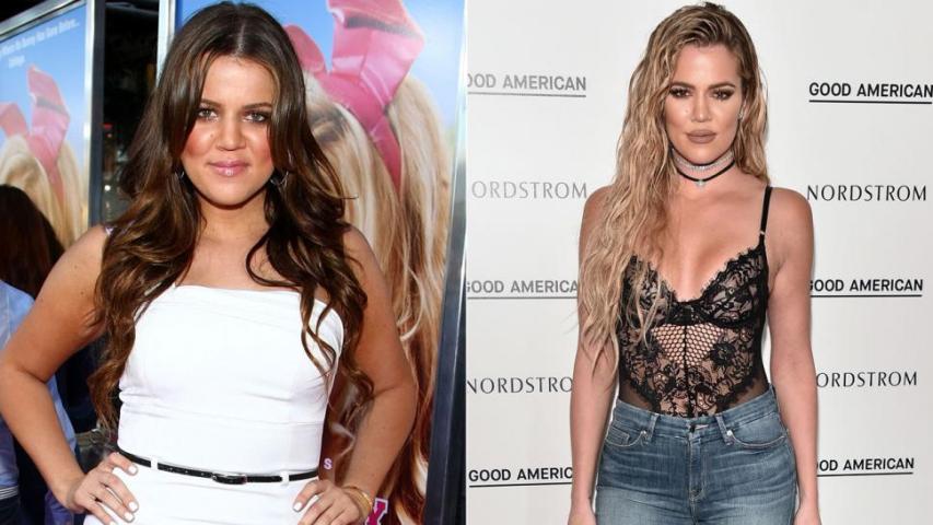 Η ολική «μεταμόρφωση» της Khloe Kardashian μέσα από 10 + 1 φωτογραφίες Η ολική «μεταμόρφωση» της Khloe Kardashian μέσα από 10 + 1 φωτογραφίες