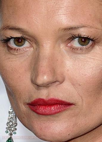 10 + 1 celebrities στα close-ups που αποδεικνύουν πως κανείς δεν είναι τέλειος