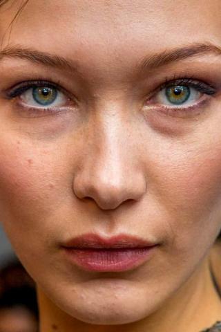 10 + 1 celebrities στα close-ups που αποδεικνύουν πως κανείς δεν είναι τέλειος