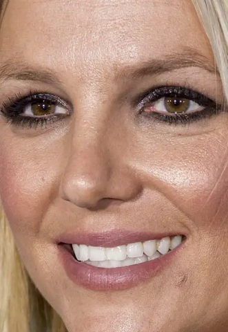 10 + 1 celebrities στα close-ups που αποδεικνύουν πως κανείς δεν είναι τέλειος