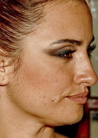 10 + 1 celebrities στα close-ups που αποδεικνύουν πως κανείς δεν είναι τέλειος