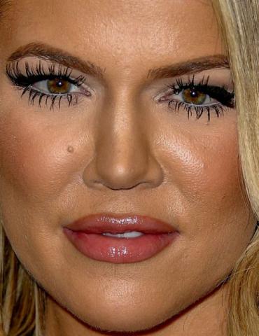 10 + 1 celebrities στα close-ups που αποδεικνύουν πως κανείς δεν είναι τέλειος