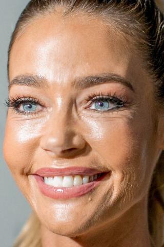 10 + 1 celebrities στα close-ups που αποδεικνύουν πως κανείς δεν είναι τέλειος