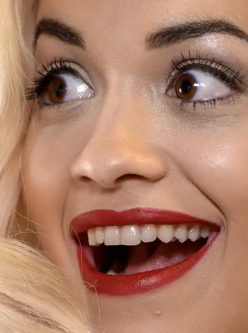 10 + 1 celebrities στα close-ups που αποδεικνύουν πως κανείς δεν είναι τέλειος