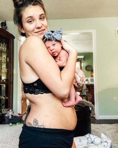 This is postpartum: Η αληθινή καμπάνια για το σώμα μετά τη γέννα