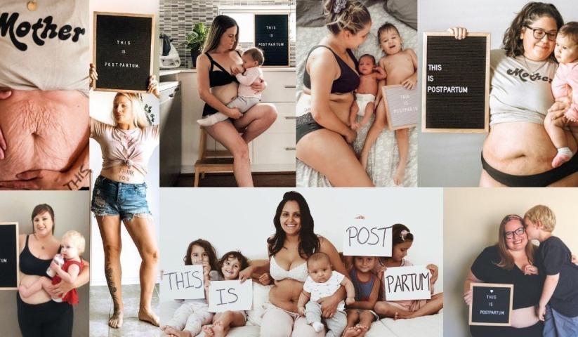 This is postpartum: Η αληθινή καμπάνια για το σώμα μετά τη γέννα