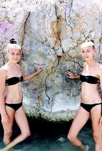 14χρονες δίδυμες κατέληξαν σε κώμα όταν σχολή modeling τις προέτρεψε να χάσουν περισσότερο βάρος 14χρονες δίδυμες κατέληξαν σε κώμα όταν σχολή modeling τις προέτρεψε να χάσουν περισσότερο βάρος