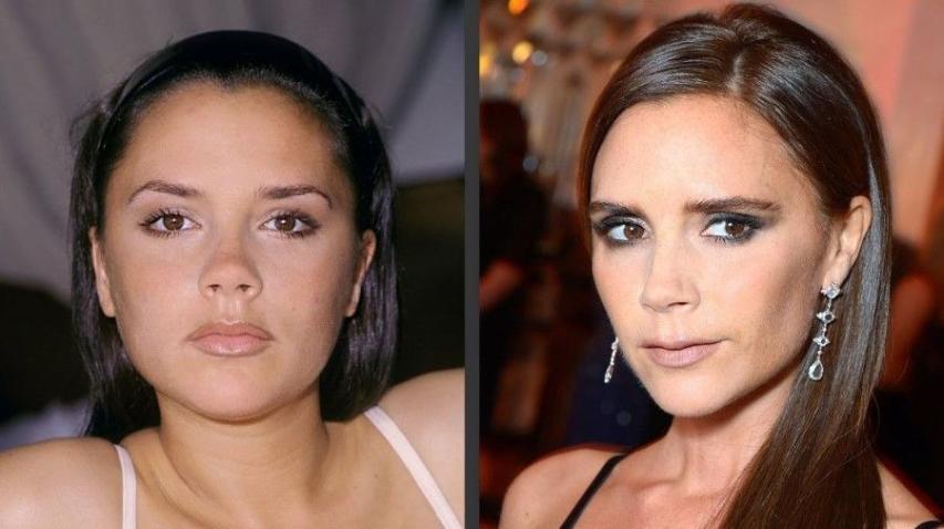 Victoria Beckham: Πόσο την άλλαξαν οι πλαστικές επεμβάσεις όλα αυτά τα χρόνια; Victoria Beckham: Πόσο την άλλαξαν οι πλαστικές επεμβάσεις όλα αυτά τα χρόνια;