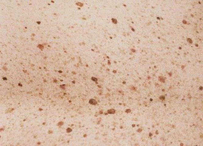 10 λήψεις που αποδεικνύουν πως η ομορφιά της γυναίκας δεν βρίσκεται στην τελειότητα