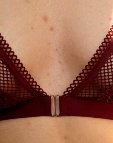 10 λήψεις που αποδεικνύουν πως η ομορφιά της γυναίκας δεν βρίσκεται στην τελειότητα