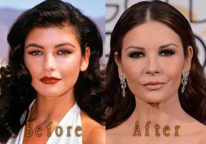 Catherine Zeta-Jones: Μήπως υπερέβαλλε με τις πλαστικές; Catherine Zeta-Jones: Μήπως υπερέβαλλε με τις πλαστικές;