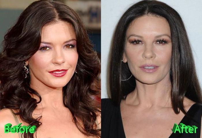 Catherine Zeta-Jones: Μήπως υπερέβαλλε με τις πλαστικές; Catherine Zeta-Jones: Μήπως υπερέβαλλε με τις πλαστικές;