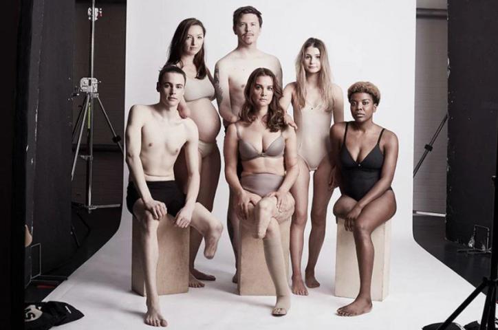 Η εμβληματική φωτογράφιση που αποδεικνύει πως η ομορφιά δεν μετριέται στα σημάδια Η εμβληματική φωτογράφιση που αποδεικνύει πως η ομορφιά δεν μετριέται στα σημάδια