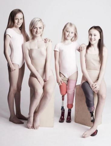 Η εμβληματική φωτογράφιση που αποδεικνύει πως η ομορφιά δεν μετριέται στα σημάδια Η εμβληματική φωτογράφιση που αποδεικνύει πως η ομορφιά δεν μετριέται στα σημάδια