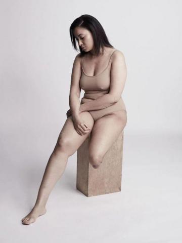 Η εμβληματική φωτογράφιση που αποδεικνύει πως η ομορφιά δεν μετριέται στα σημάδια Η εμβληματική φωτογράφιση που αποδεικνύει πως η ομορφιά δεν μετριέται στα σημάδια