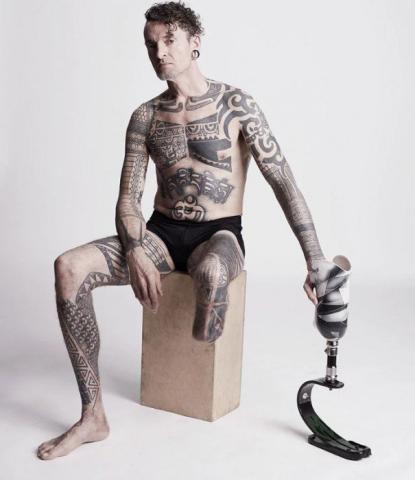 Η εμβληματική φωτογράφιση που αποδεικνύει πως η ομορφιά δεν μετριέται στα σημάδια Η εμβληματική φωτογράφιση που αποδεικνύει πως η ομορφιά δεν μετριέται στα σημάδια