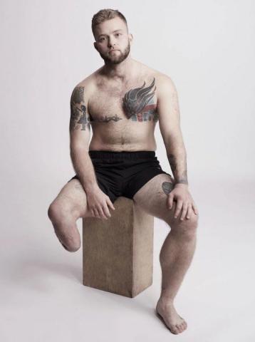 Η εμβληματική φωτογράφιση που αποδεικνύει πως η ομορφιά δεν μετριέται στα σημάδια Η εμβληματική φωτογράφιση που αποδεικνύει πως η ομορφιά δεν μετριέται στα σημάδια